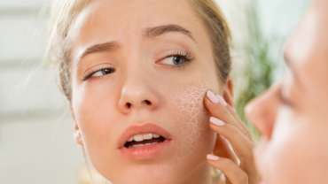 How to fix dry skin